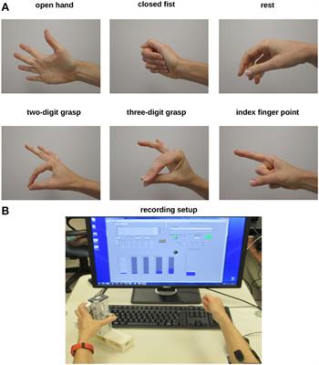 Proof of Concept of an Online EMG-Based Decoding of Hand Postures and Individual Digit Forces for Prosthetic Hand Control